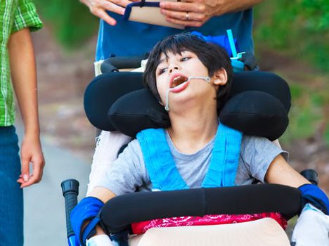 Questions on Birth Injuries