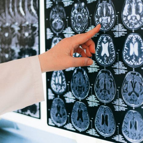 brain injury scan attorney lawsuit