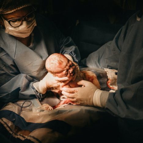 child birth c-section