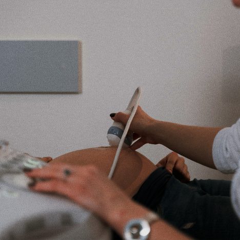 Ultrasound